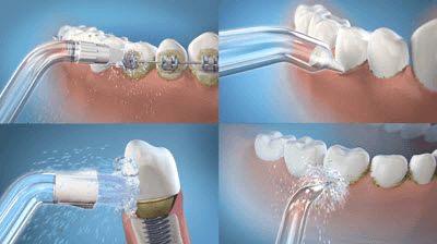 HydroSmile: el irrigador bucal que transformará tu sonrisa